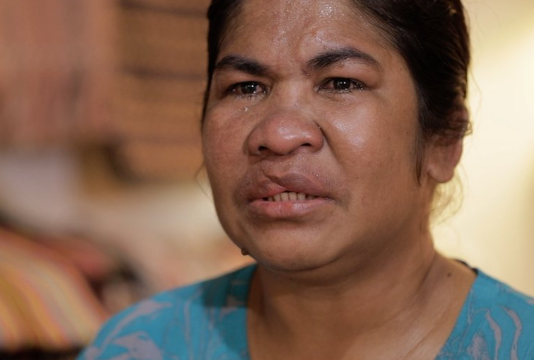 Seorang Majikan di Malaysia Menyiram Air Panas ke Mulut TKI